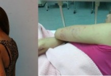 Amanda Fong Kim Yen Hammered by Her Husband Amanda Fong Kim Yen beaten by Her Husband