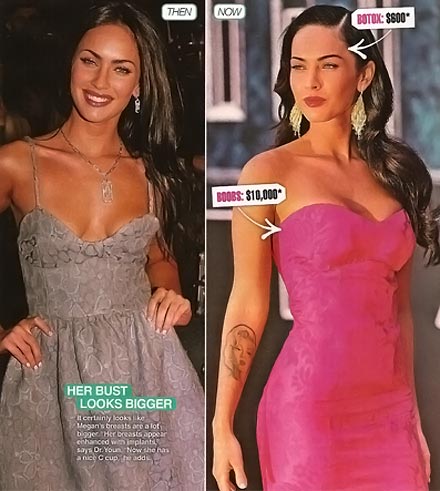 megan-fox-before-after-surgery breast
