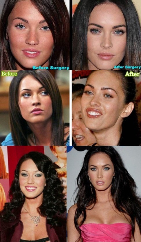 megan fox before and after
